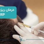 درمان prp برای ریزش مو
