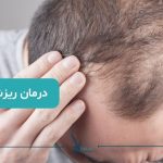 درمان ریزش مو مردان
