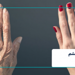 جوانسازی دست با اندولیفت