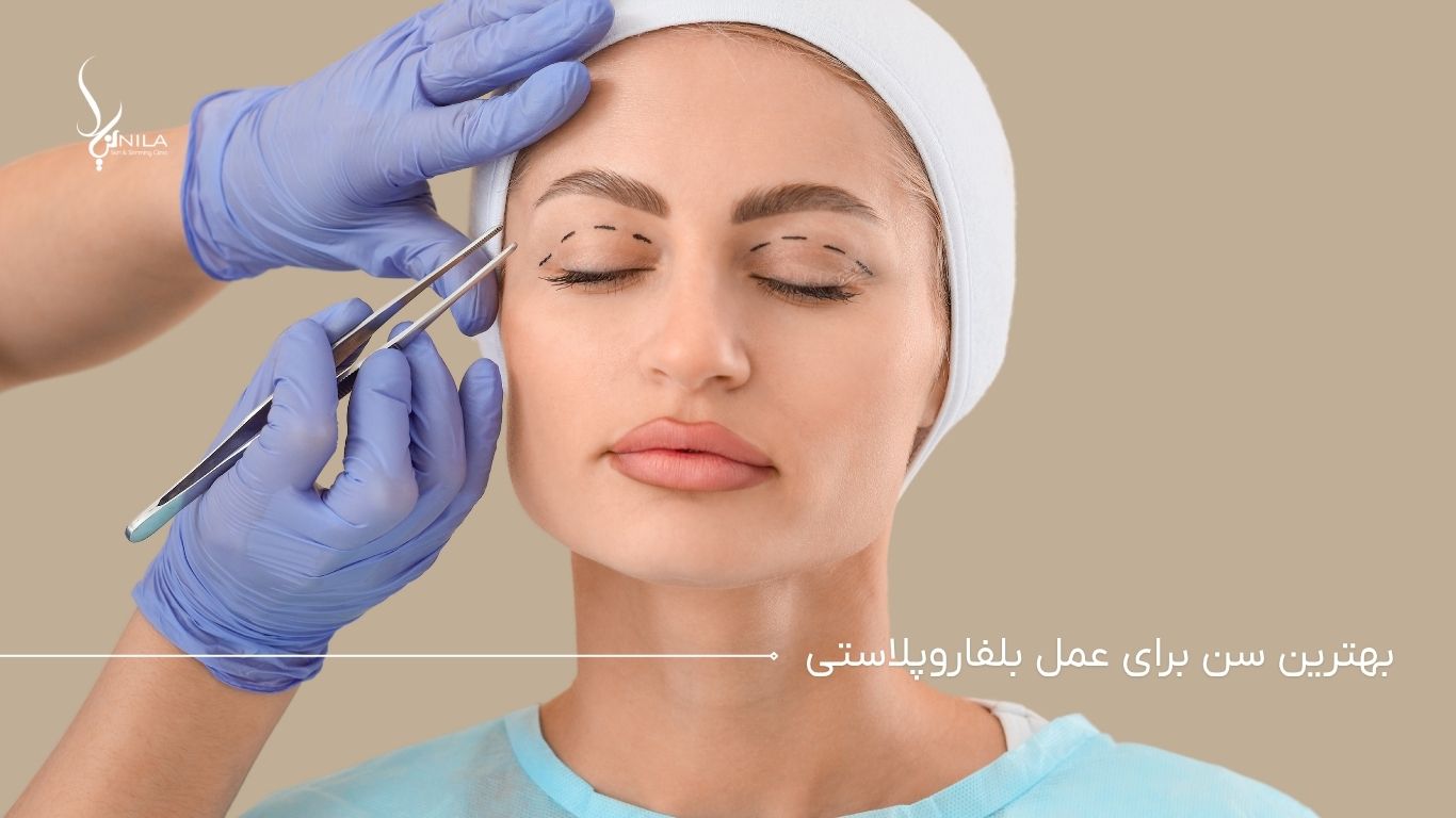 بهترین سن برای عمل بلفاروپلاستی