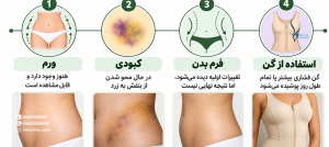 دوه نقاهت لیپوساکشن